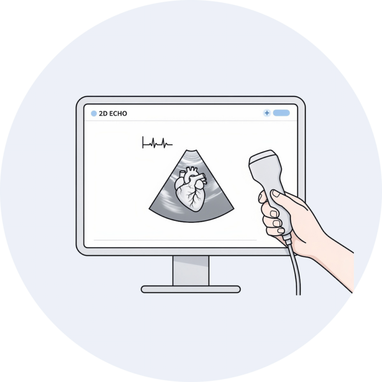 Illustration of a 2D echo heart scan shown on a monitor with a probe.